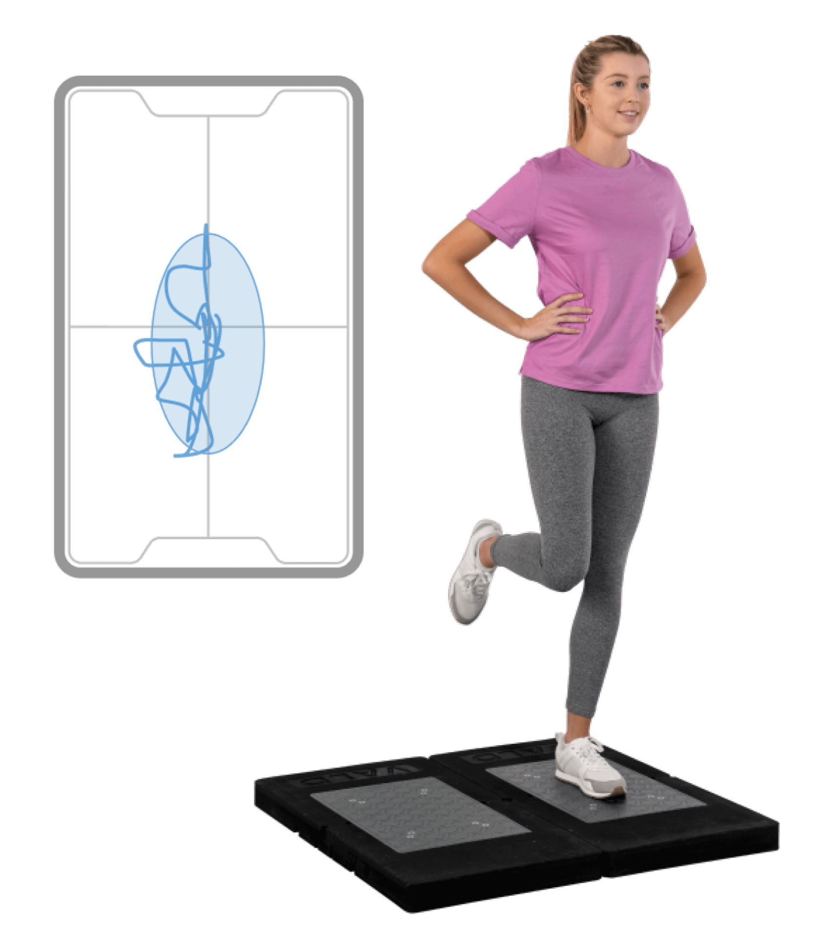The patient is performing a single leg stand with a center of pressure (CoP) trace.