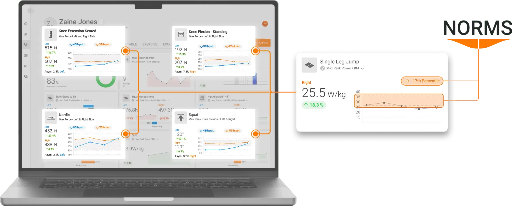 ForceDecks, DynaMo, NordBord, ForceFrame and HumanTrak Norms (normative data) integrated into VALD Hub.
