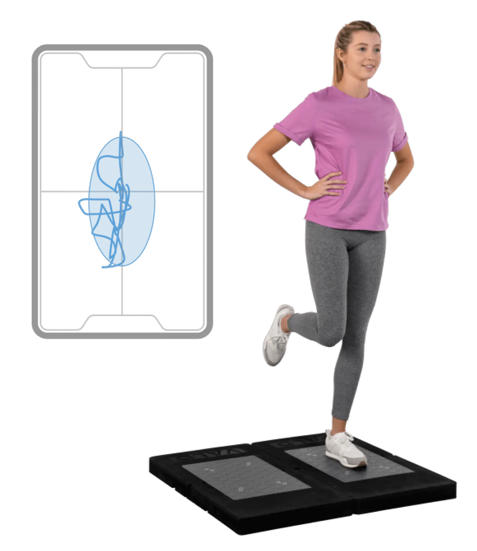 The patient is performing a single leg stand with a center of pressure (CoP) trace.