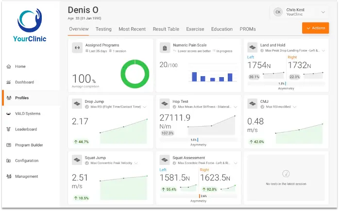 VALD 허브는 시간이 흐름에 따라 크게 발전하여 현재의 버전은 거의 처음 출시된 버전과 구별하기 어렵습니다.